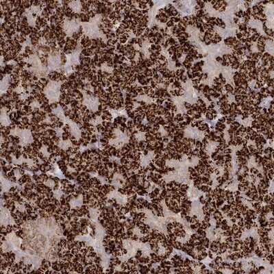 Immunohistochemistry-Paraffin: TGFBRAP1 Antibody [NBP1-80668]