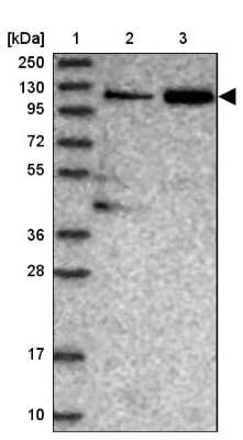 Western Blot: TGFBRAP1 Antibody [NBP1-80668]