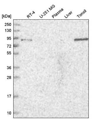 Western Blot: TGFBRAP1 Antibody [NBP2-58528]