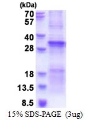 SDS-PAGE: Recombinant Human TGFBRAP1 His Protein [NBP2-51602]