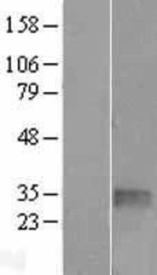 Western Blot: TGIF1 Overexpression Lysate [NBL1-16861]