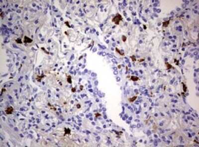 Immunohistochemistry: TGIF1 Antibody (OTI1B12) [NBP2-46109]
