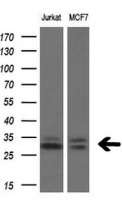 Western Blot: TGIF1 Antibody (OTI1B12) [NBP2-46109]