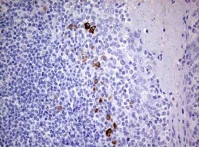 Immunohistochemistry: TGIF1 Antibody (OTI1B12) - Azide and BSA Free [NBP2-74496]