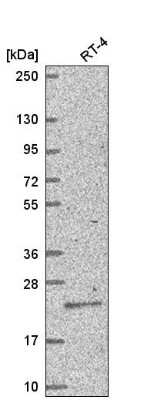 Western Blot: TGIF1 Antibody [NBP2-55829]