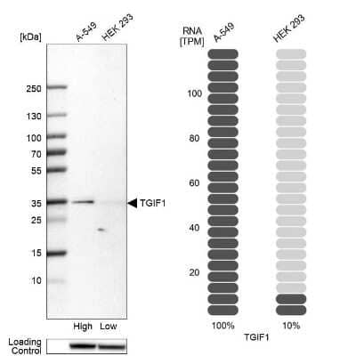 Western Blot: TGIF1 Antibody [NBP2-55829]