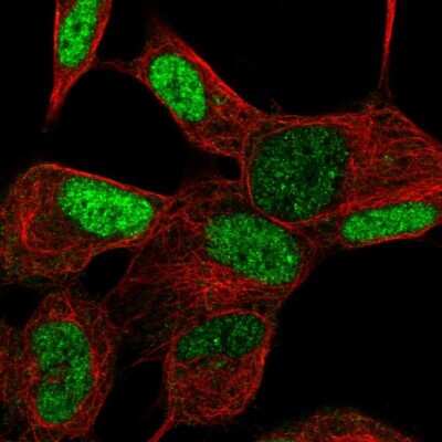 Immunocytochemistry/ Immunofluorescence: TGIF2LX Antibody [NBP1-86320]