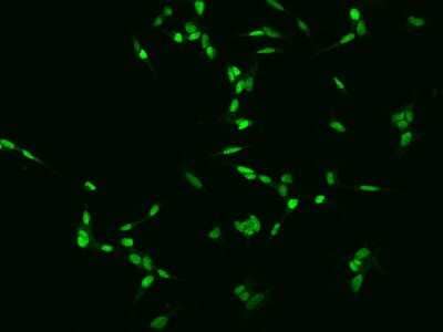 Immunocytochemistry/ Immunofluorescence: TGIF2LX Antibody [NBP2-98060]