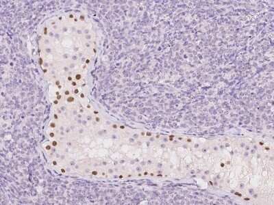 Immunohistochemistry-Paraffin: TGIF2LX Antibody [NBP2-98060]