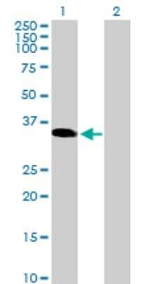 Western Blot: TGIF2LX Antibody [H00090316-B01P]