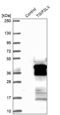 Western Blot: TGIF2LX Antibody [NBP1-86320]