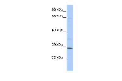 Western Blot: TGIF2LX Antibody [NBP2-85906]