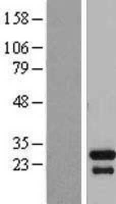 Western Blot: TGIF2LX Overexpression Lysate [NBP2-05599]