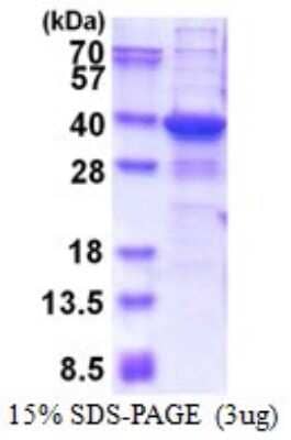 SDS-PAGE: Recombinant Human TGIF2LX His Protein [NBP2-51616]