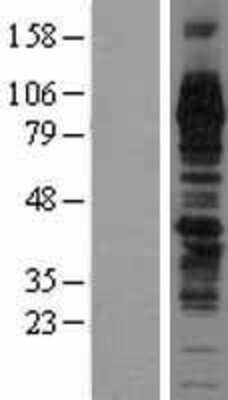 Western Blot: TGN38 Overexpression Lysate [NBL1-16869]