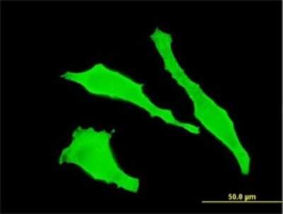 Immunocytochemistry/ Immunofluorescence: TGN46 Antibody (2F11) [H00010618-M02]