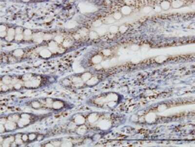 Immunohistochemistry-Paraffin: TGN46 Antibody (2F11) [H00010618-M02]