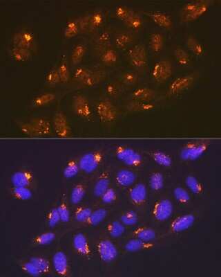 Immunocytochemistry/ Immunofluorescence: TGN46 Antibody (9G5X6) [NBP3-15817]