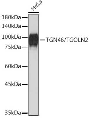 Western Blot: TGN46 Antibody (9G5X6) [NBP3-15817]