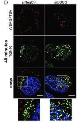 Immunocytochemistry/ Immunofluorescence: TGN46 Antibody - BSA Free [NBP1-49643]
