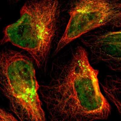 Immunocytochemistry/ Immunofluorescence: TGN46 Antibody [NBP1-86949]