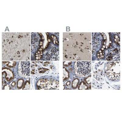 Immunohistochemistry-Paraffin: TGN46 Antibody [NBP1-86948]
