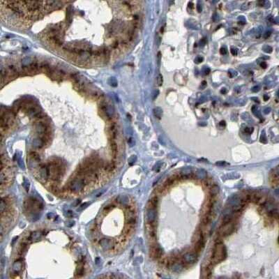 Immunohistochemistry-Paraffin: TGN46 Antibody [NBP1-86948]