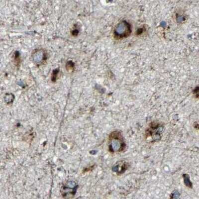 Immunohistochemistry-Paraffin: TGN46 Antibody [NBP1-86948]