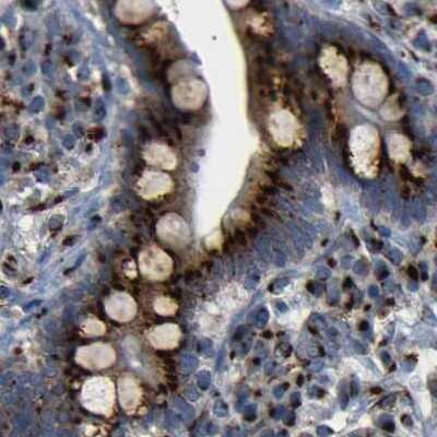 Immunohistochemistry-Paraffin: TGN46 Antibody [NBP1-86948]