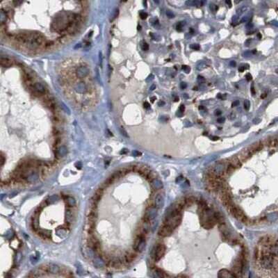 Immunohistochemistry-Paraffin: TGN46 Antibody [NBP1-86949]