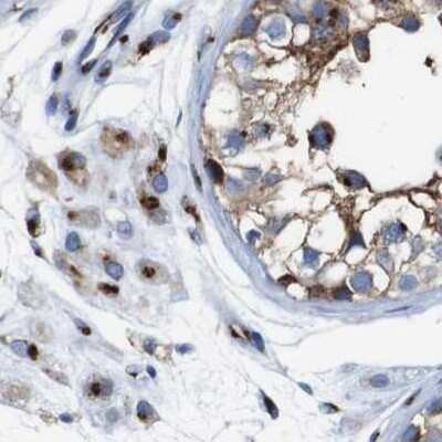 Immunohistochemistry-Paraffin: TGN46 Antibody [NBP1-86949]