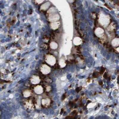 Immunohistochemistry-Paraffin: TGN46 Antibody [NBP1-86949]