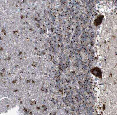 Immunohistochemistry-Paraffin: TGN46 Antibody [NBP1-86949]