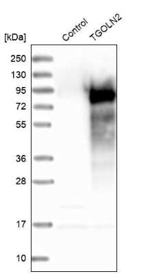 Western Blot: TGN46 Antibody [NBP1-86948]