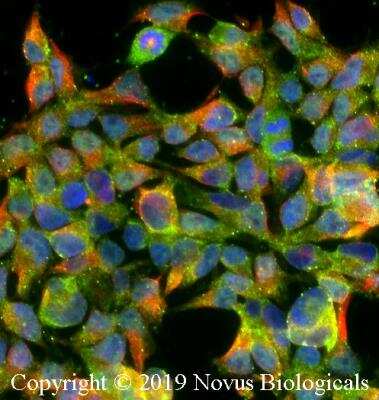 Immunocytochemistry/ Immunofluorescence: TGR5/GPBAR1 Antibody - BSA Free [NBP2-23669]