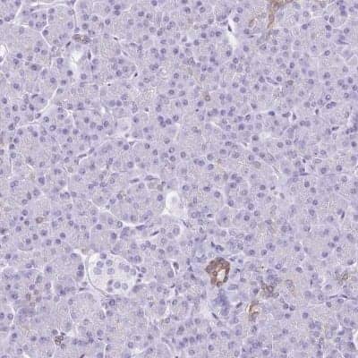 Immunohistochemistry-Paraffin: TGR5/GPBAR1 Antibody [NBP2-49376]