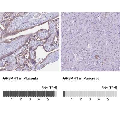 Immunohistochemistry-Paraffin: TGR5/GPBAR1 Antibody [NBP2-49376]
