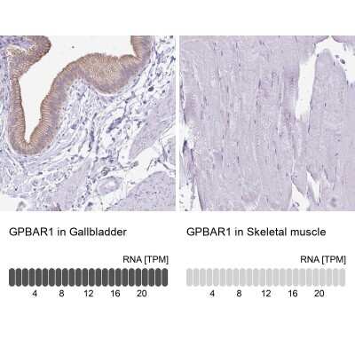 Immunohistochemistry-Paraffin: TGR5/GPBAR1 Antibody [NBP2-49376]