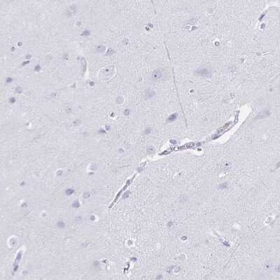 Immunohistochemistry-Paraffin: TGR5/GPBAR1 Antibody [NBP2-49376]