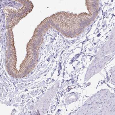 Immunohistochemistry-Paraffin: TGR5/GPBAR1 Antibody [NBP2-49376]