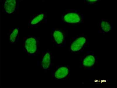 Immunocytochemistry/ Immunofluorescence: TH1L Antibody [H00051497-B01P]