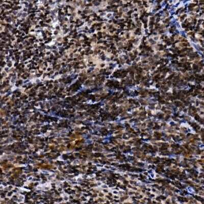 Immunohistochemistry-Paraffin: TH1L Antibody - Azide and BSA Free [NBP3-16475]