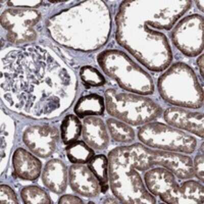 Immunohistochemistry-Paraffin: TH1L Antibody [NBP3-17948]