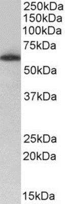 Western Blot: TH1L Antibody [NBP1-52112]