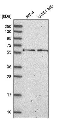 Western Blot: TH1L Antibody [NBP2-55400]