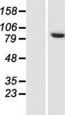 Western Blot: TH1L Overexpression Lysate [NBP2-04655]