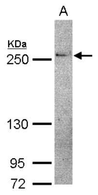 Western Blot: THADA Antibody [NBP2-20615]