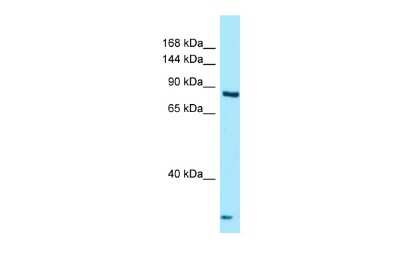 Western Blot: THADA Antibody [NBP2-85907]