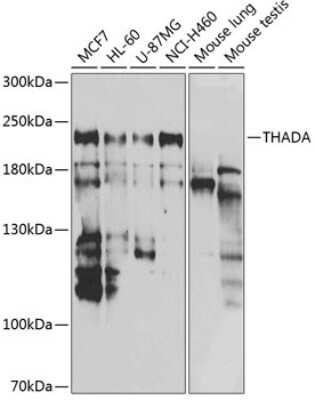 Western Blot: THADA AntibodyBSA Free [NBP2-93002]