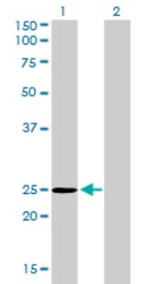 Western Blot: THAP1 Antibody (2C1-2F2) [H00055145-M01]